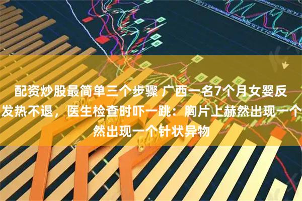 配资炒股最简单三个步骤 广西一名7个月女婴反复咳嗽、发热不退，医生检查时吓一跳：胸片上赫然出现一个针状异物